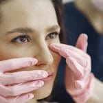 rinoplastia vs alectomía nasal