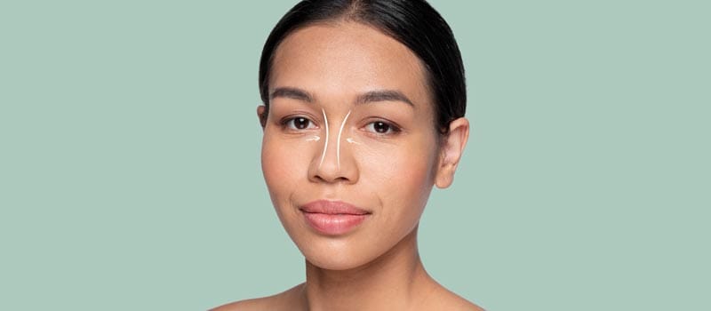 diferencia entre rinoplastia y alectomía