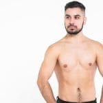 quién es candidato para cirugía de ginecomastia