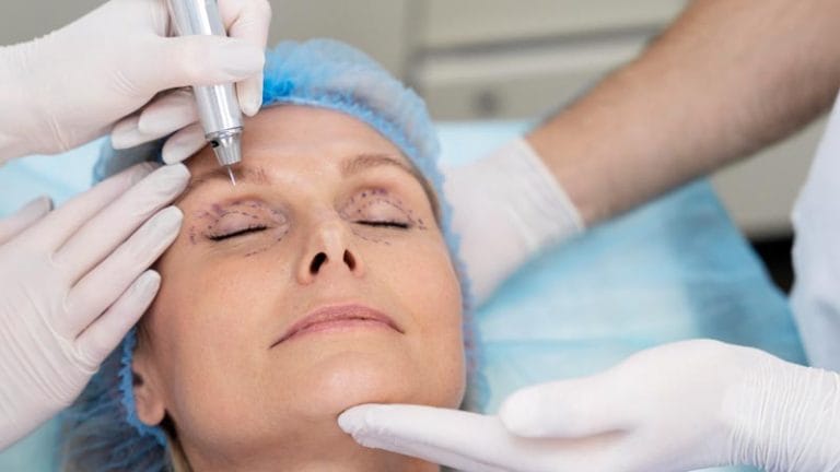 cantoplastia vs blefaroplastia