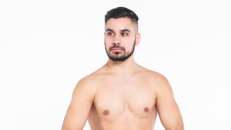Qué es la ginecomastia en hombres