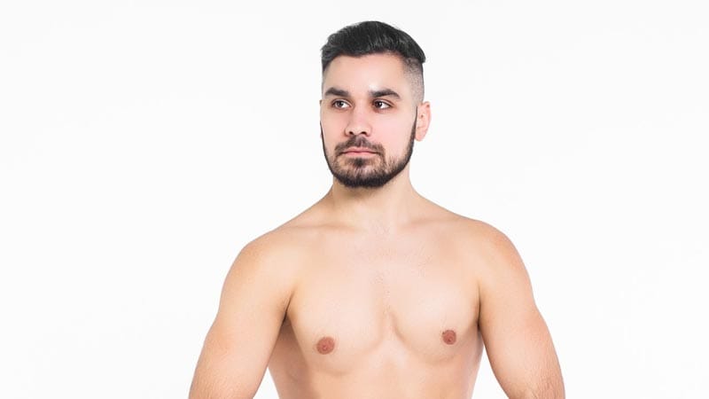 Qué es la ginecomastia en hombres